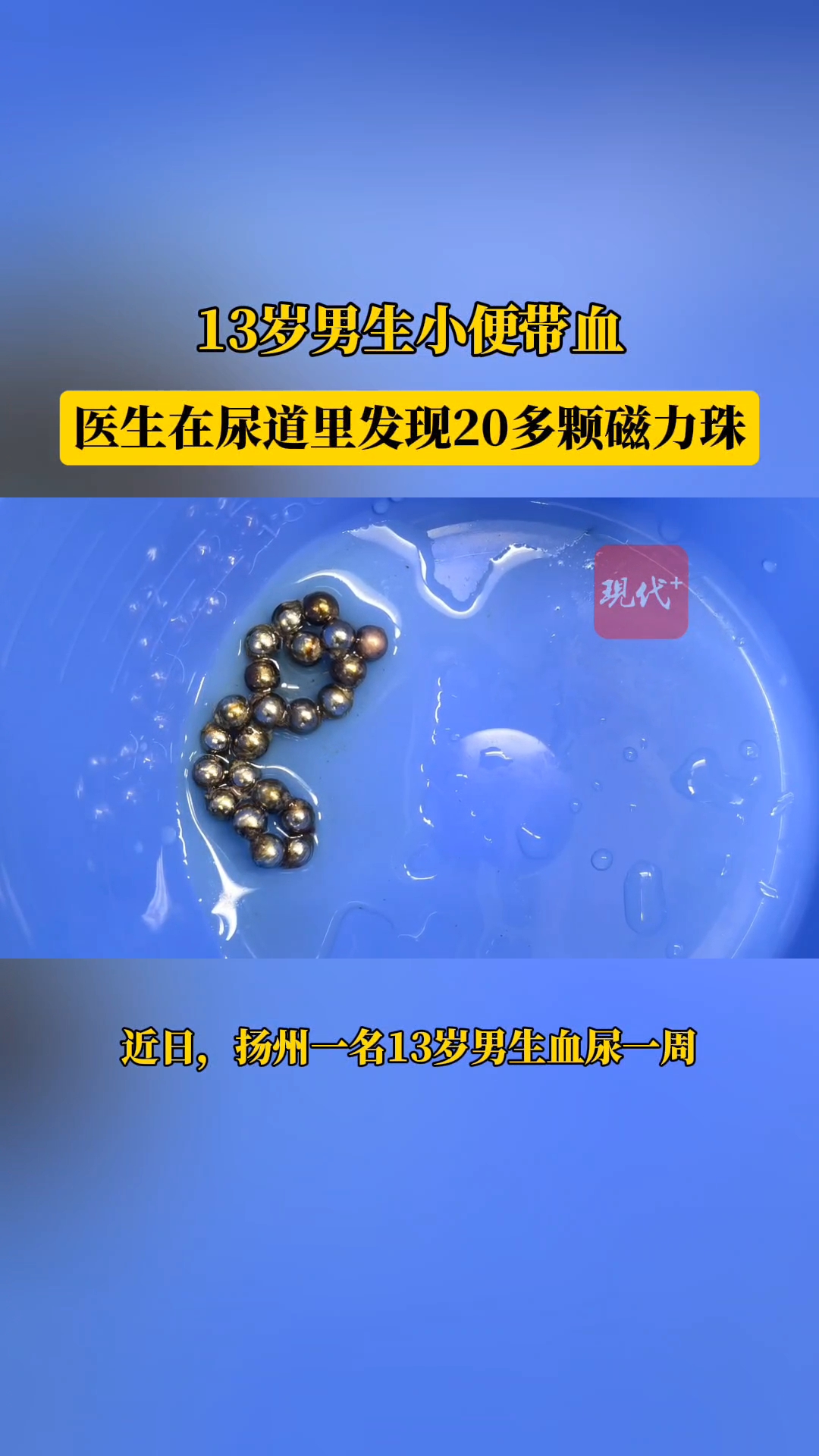 磁力珠对孩子身体有害吗=磁力珠的磁对孩子有影响么